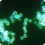 Gonorrhea virus