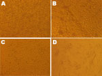 Thumbnail of Effect of chikungunya virus nucleic acid-positive serum specimens on C6/36 and BHK-21 cells, Guangdong, China, 2010. A) Control (uninfected) C6/36 cells. B) Infected C6/36 cells, showing cytopathic effect. C) Control (uninfected) BHK-21 cells. D) Infected BHK-21 cells, showing cytopathic effect. (Original magnifications ×200.)