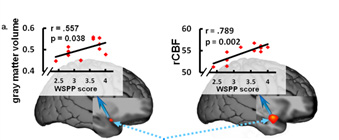Rating scale used to predict personality traits.