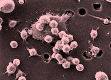 nih_photo_attacking_pancreatic_cancer_nyreblog_com_.jpg