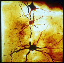 Microscope image of branched motor neurons.