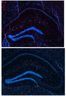 Two similar microscope images, with more red spots in the upper one.
