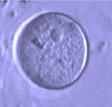Microscope image of an oocyte.