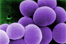 Scanning electron micrograph of Staphylococcus bacteria